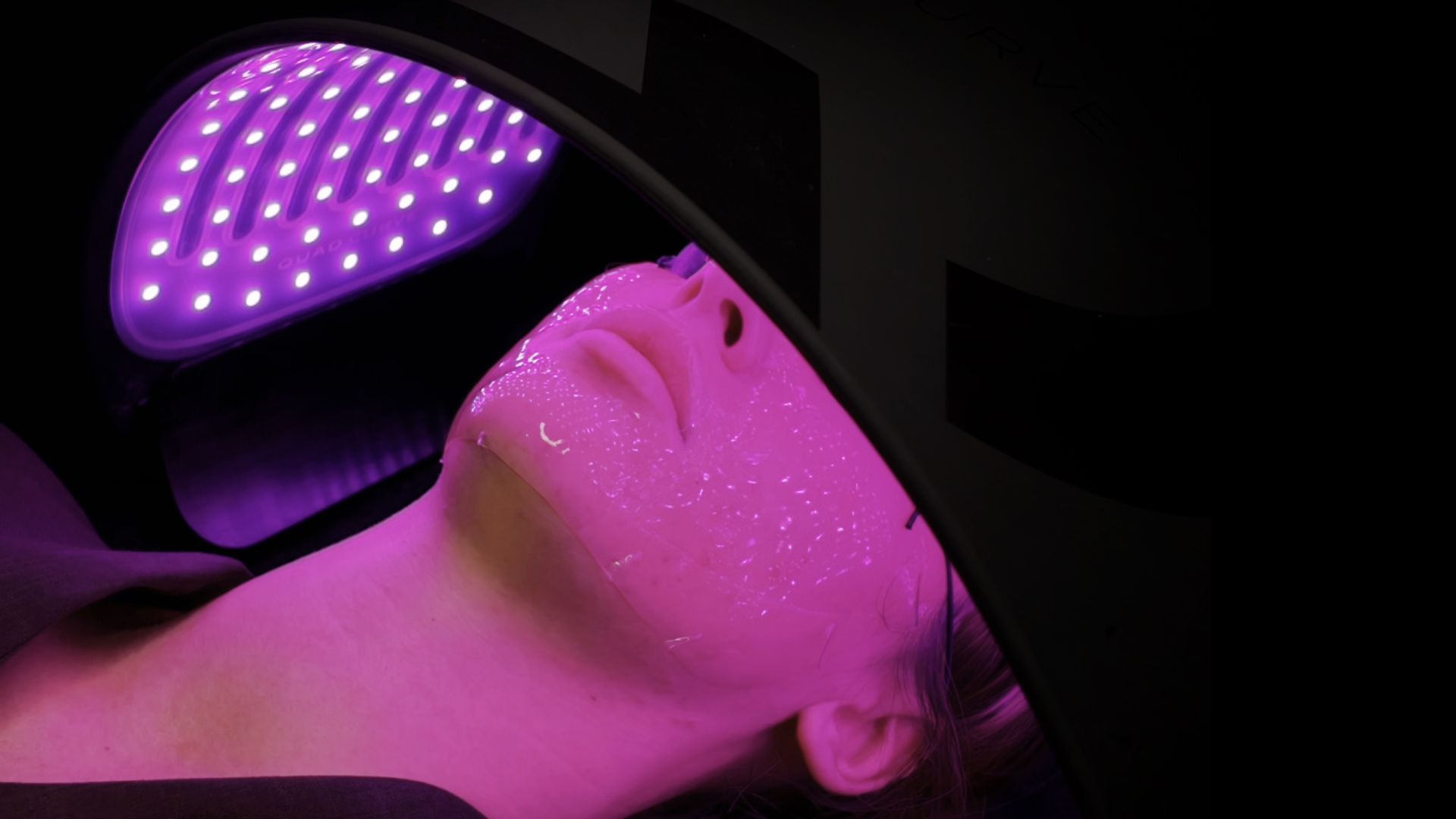 Advanced microneedling at Aurah spa in Prestwick, Ayrshire and infrared light therapyfor skin 