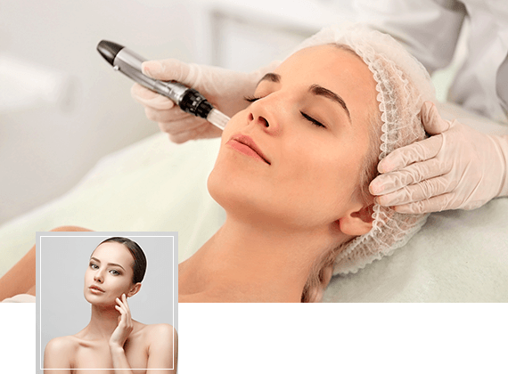 Young women having microneedling therapy