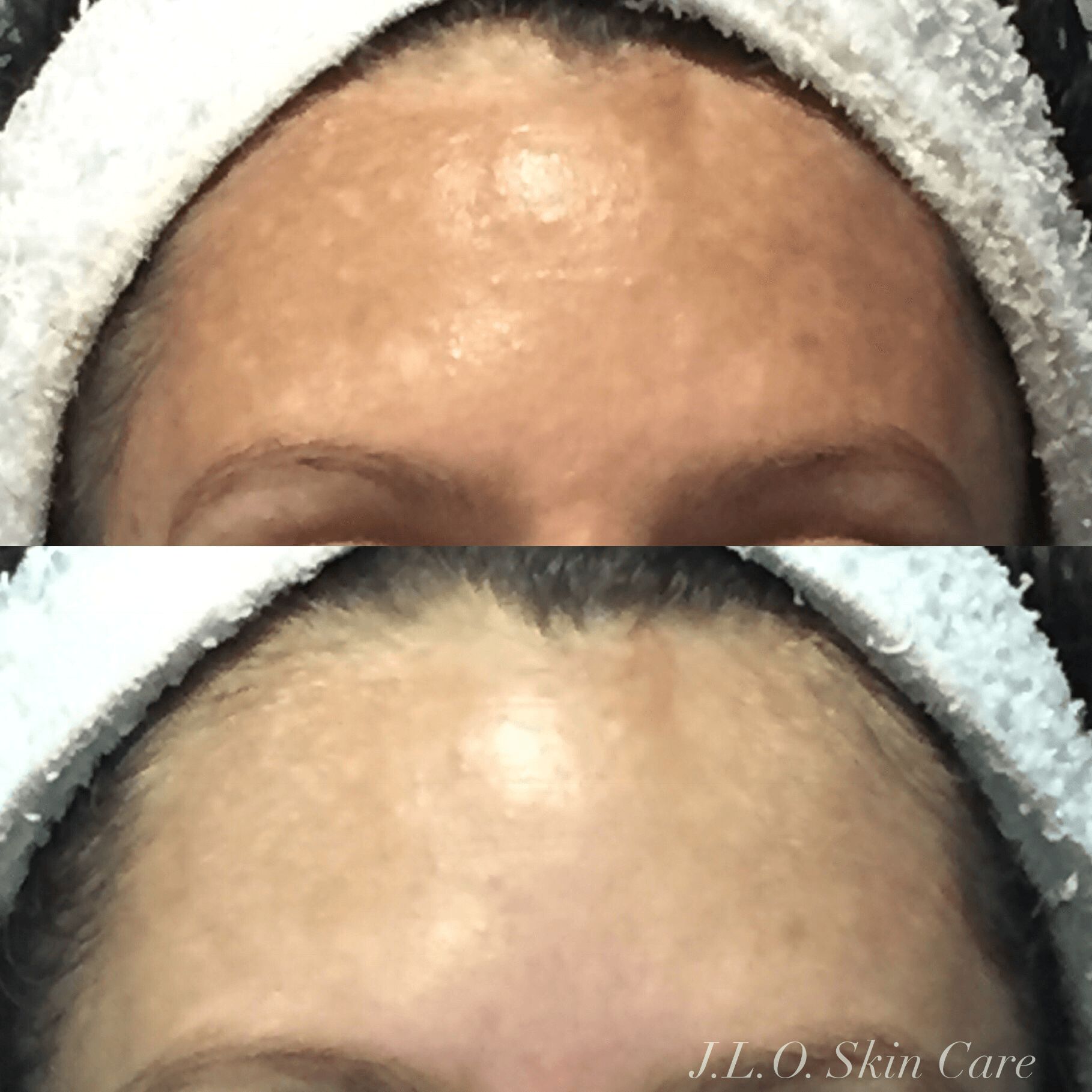Before and after getting facial treatment
