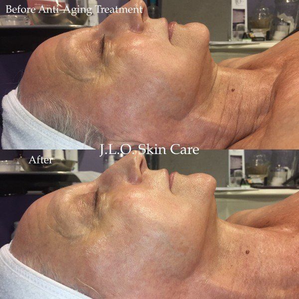 View of patient face before and after facial treatment