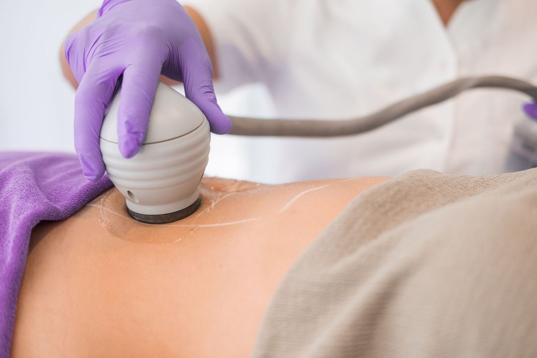 Persona sottoposta a trattamento di rimodellamento del corpo con un dispositivo portatile, mano guantata.