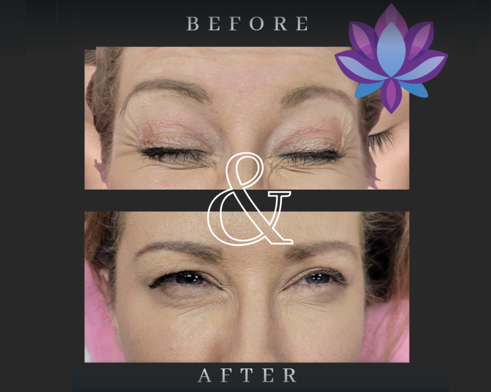 A before and after photo of a woman 's eyebrows