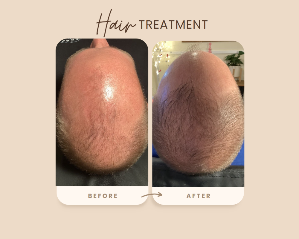 A man 's head before and after a hair treatment.