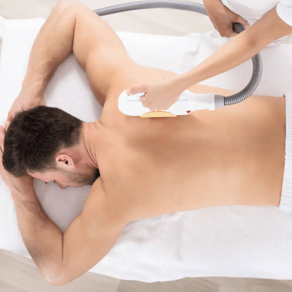 Een man krijgt een laserontharingsbehandeling op zijn rug.