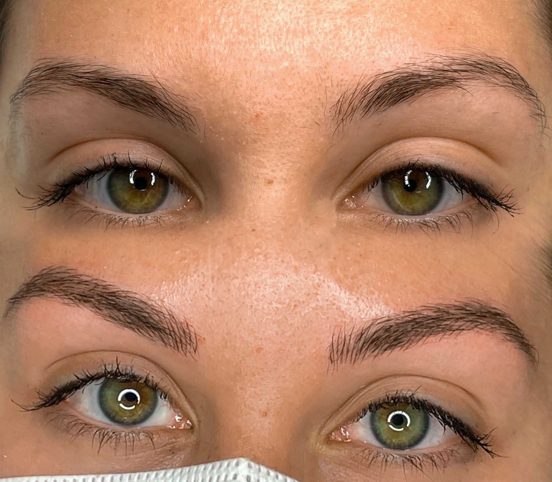 Una foto prima e dopo degli occhi di una donna