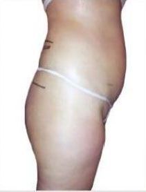 Il ventre di una donna è raffigurato con un filo bianco attorno ad esso.