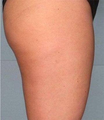 Un primo piano della gamba di una donna con uno sfondo grigio.