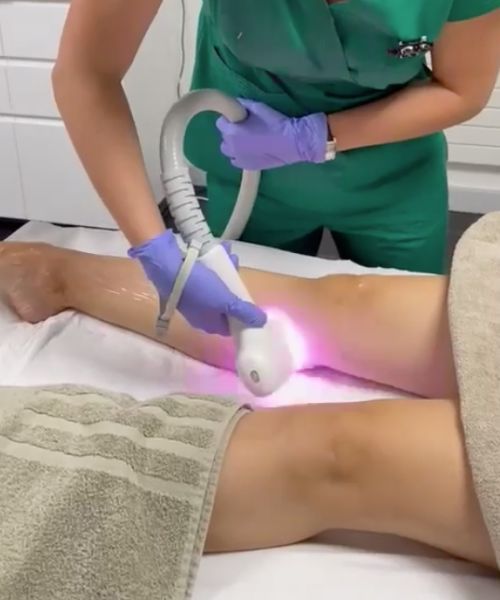 Una donna sta ricevendo un trattamento laser sulla gamba