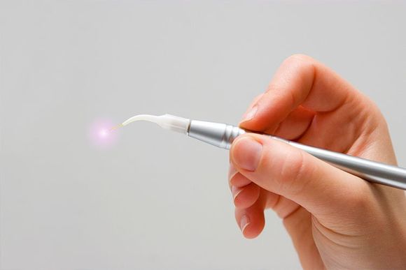 Laser Gum Therapy