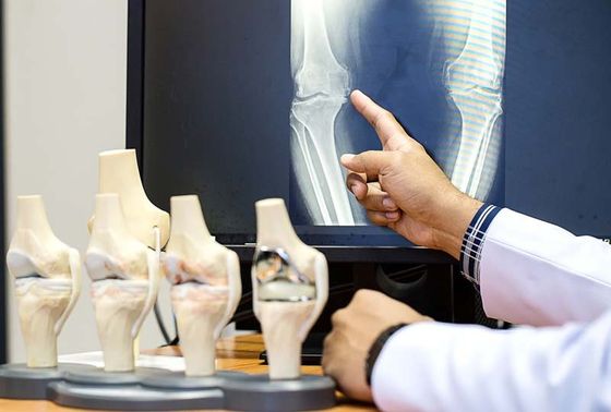 Sports Medicine — X-ray of Bone in Lake Success, NY