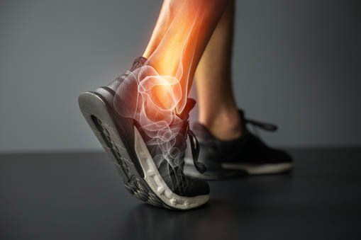 Football Injury —  X-ray of Ankle in Lake Success, NY