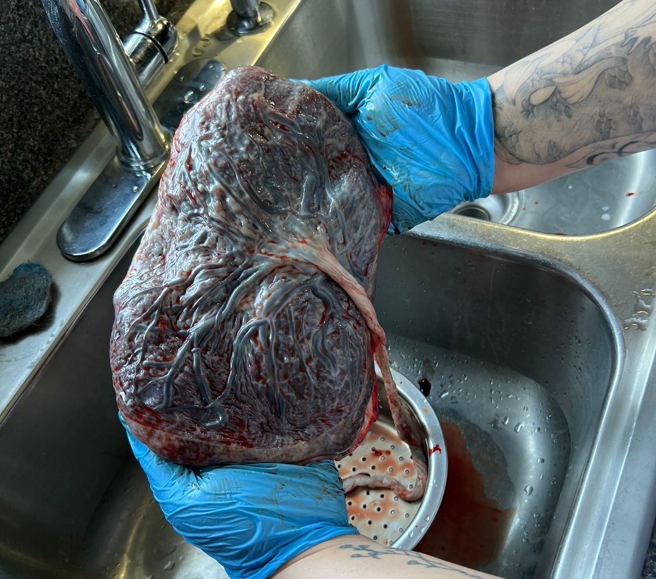 Placenta Encapsulation in Winston-Salem, Placenta encapsulation near Winston-Salem, Placenta encapsulation in the piedmont