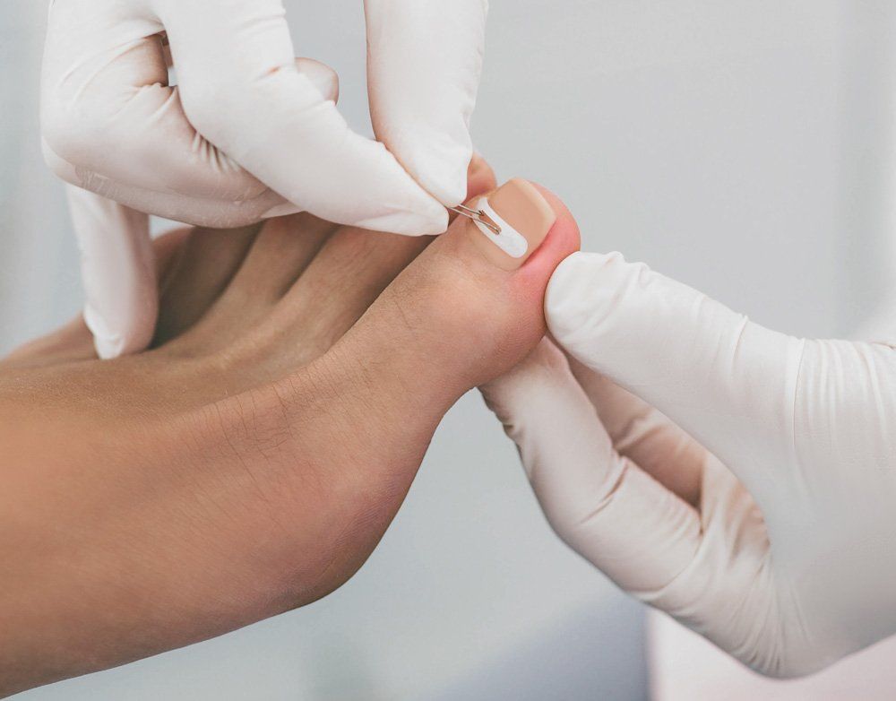 Hands in gloves examining a toe with a damaged nail in a medical setting.