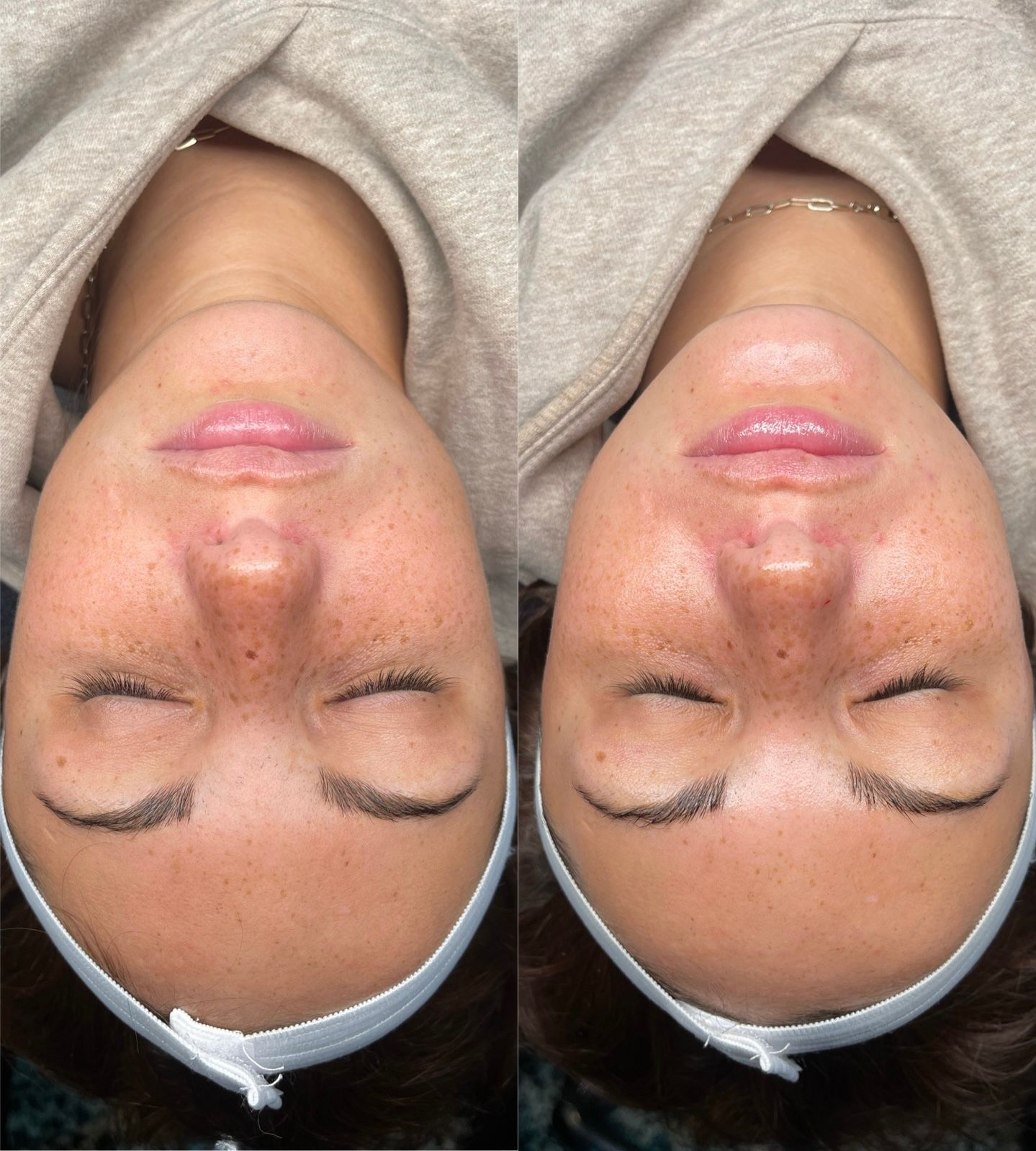 A woman is laying down with her head upside down and her eyes closed.