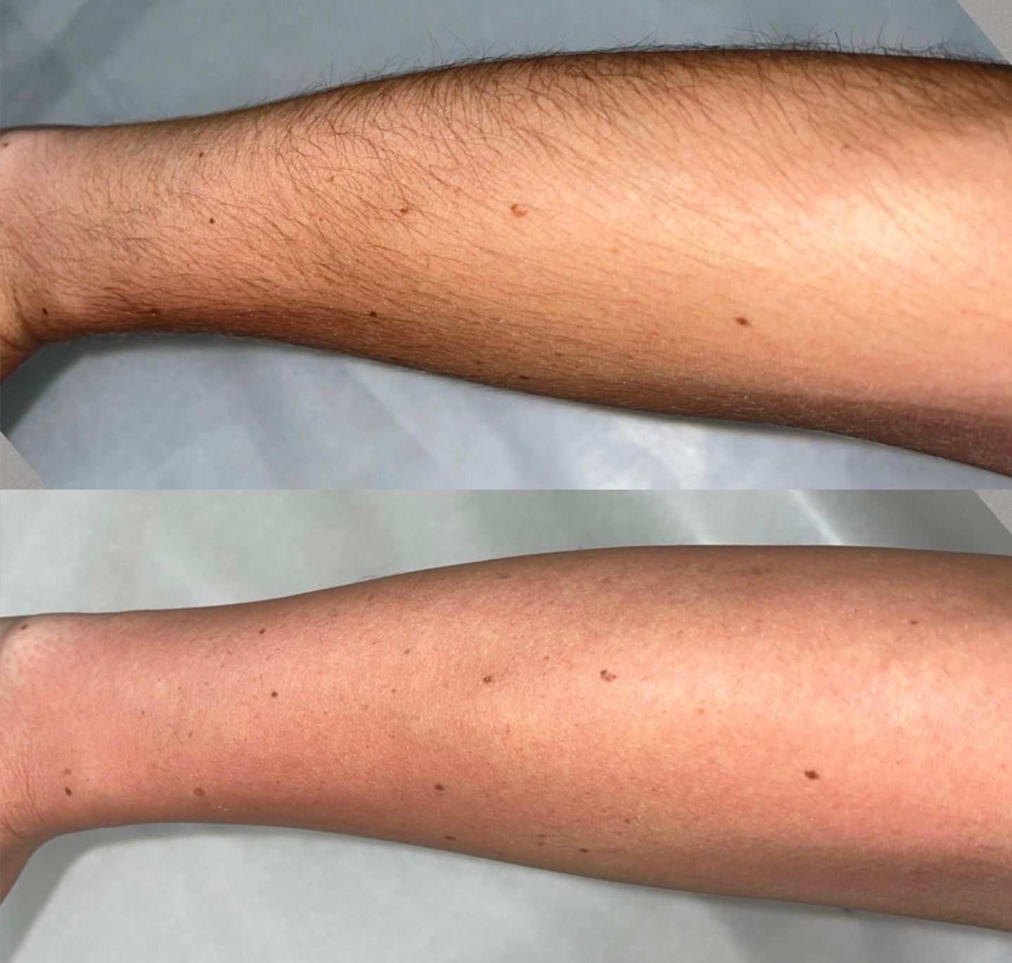 A before and after picture of a person 's arm.