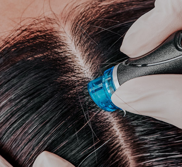 A woman is getting a hair treatment with a machine.