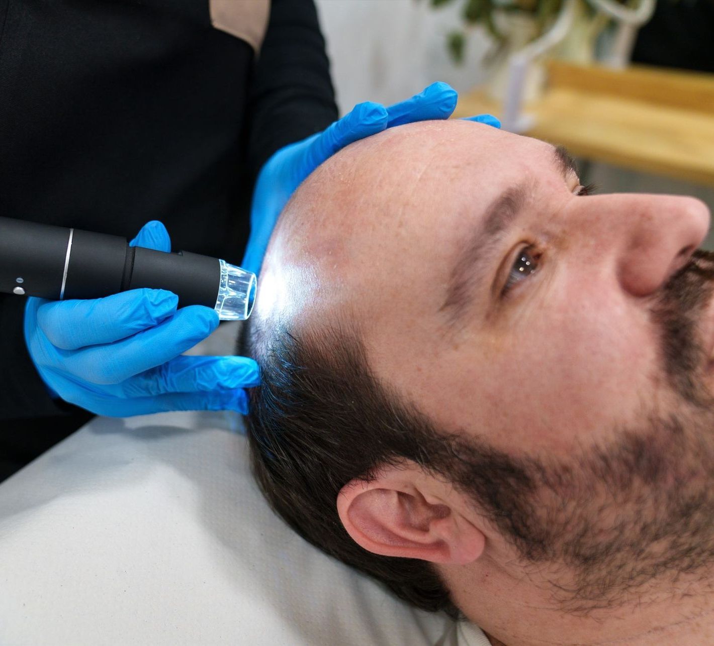 A man with a beard is getting a treatment on his head