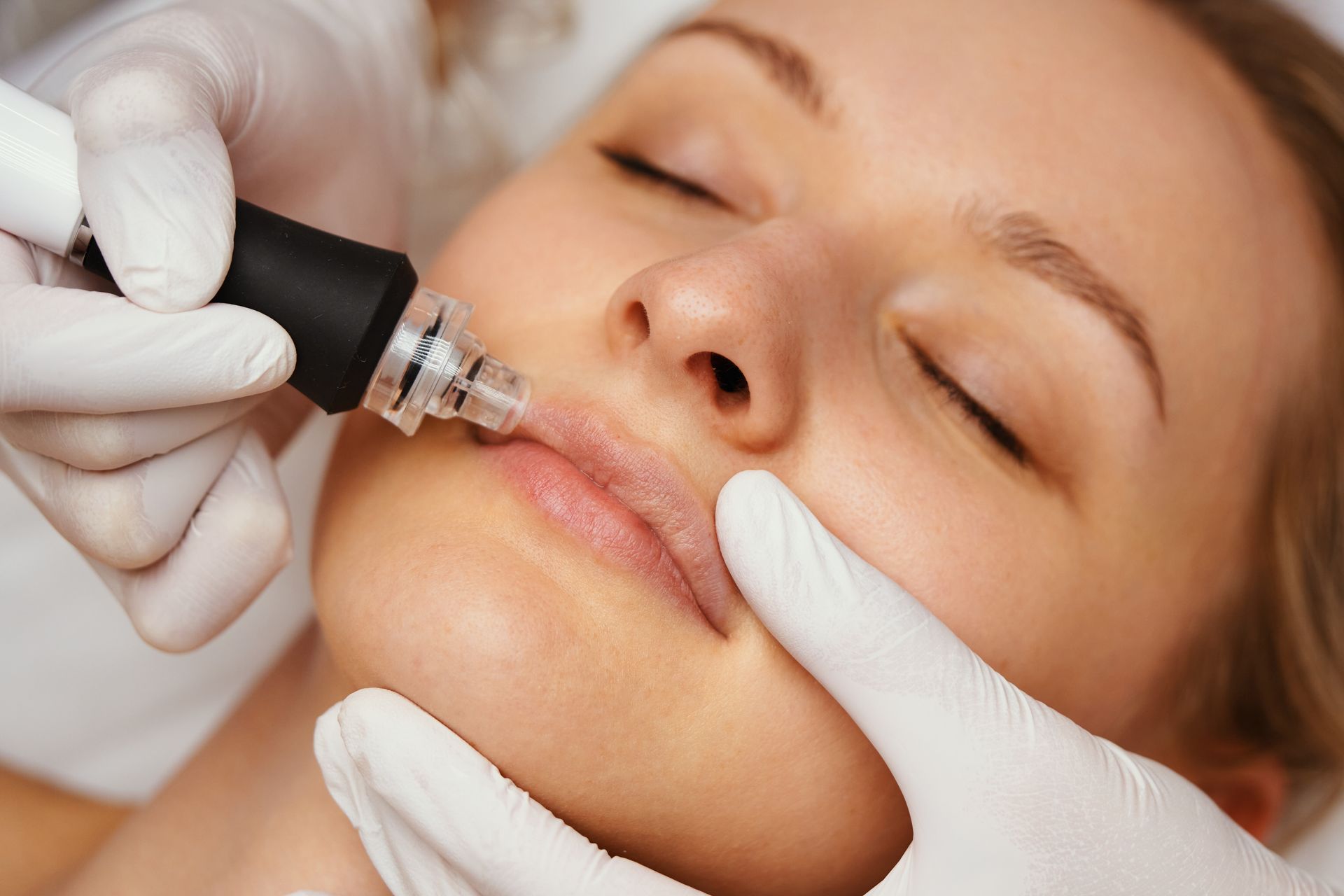 A woman is getting a botox treatment on her lips.