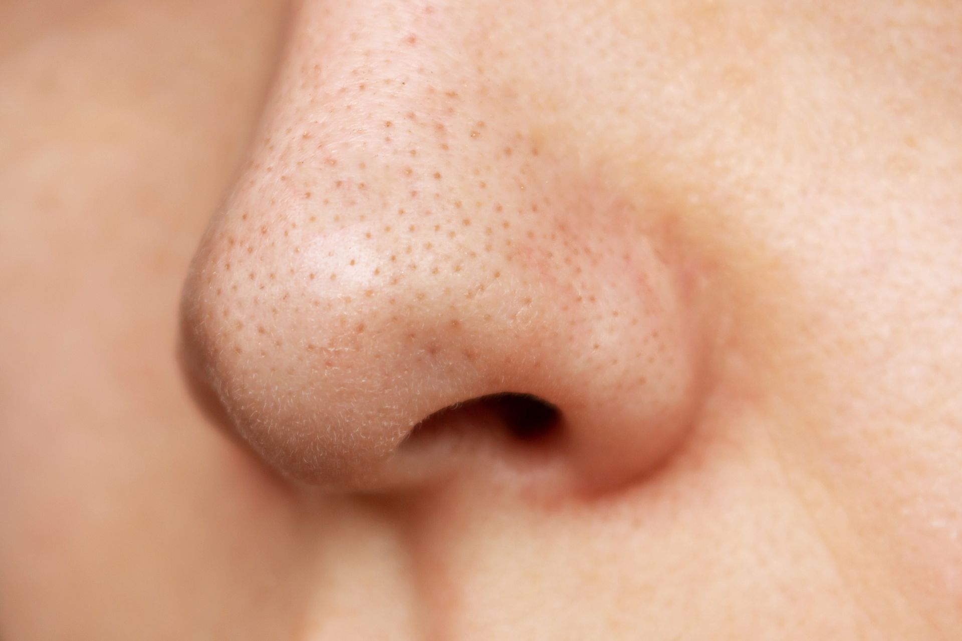 Close-up of a person's nose, showing pores on the skin.