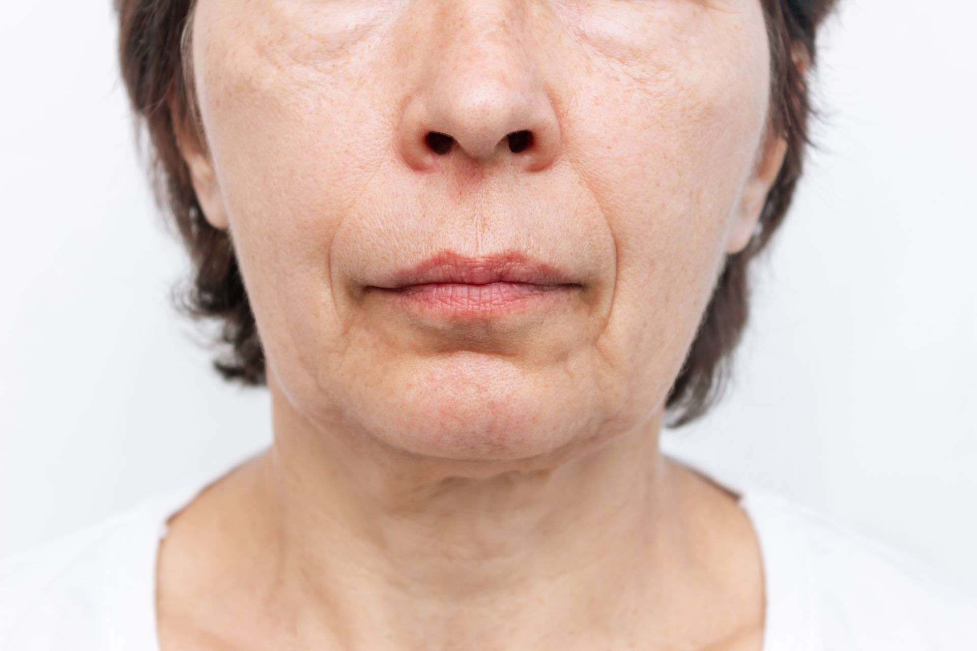 Close-up of a person's face showing wrinkles around the eyes, mouth, and neck on a white background.