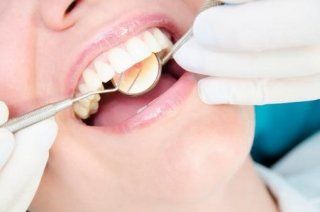 dentista controlla denti di paziente con specchietto e specillo