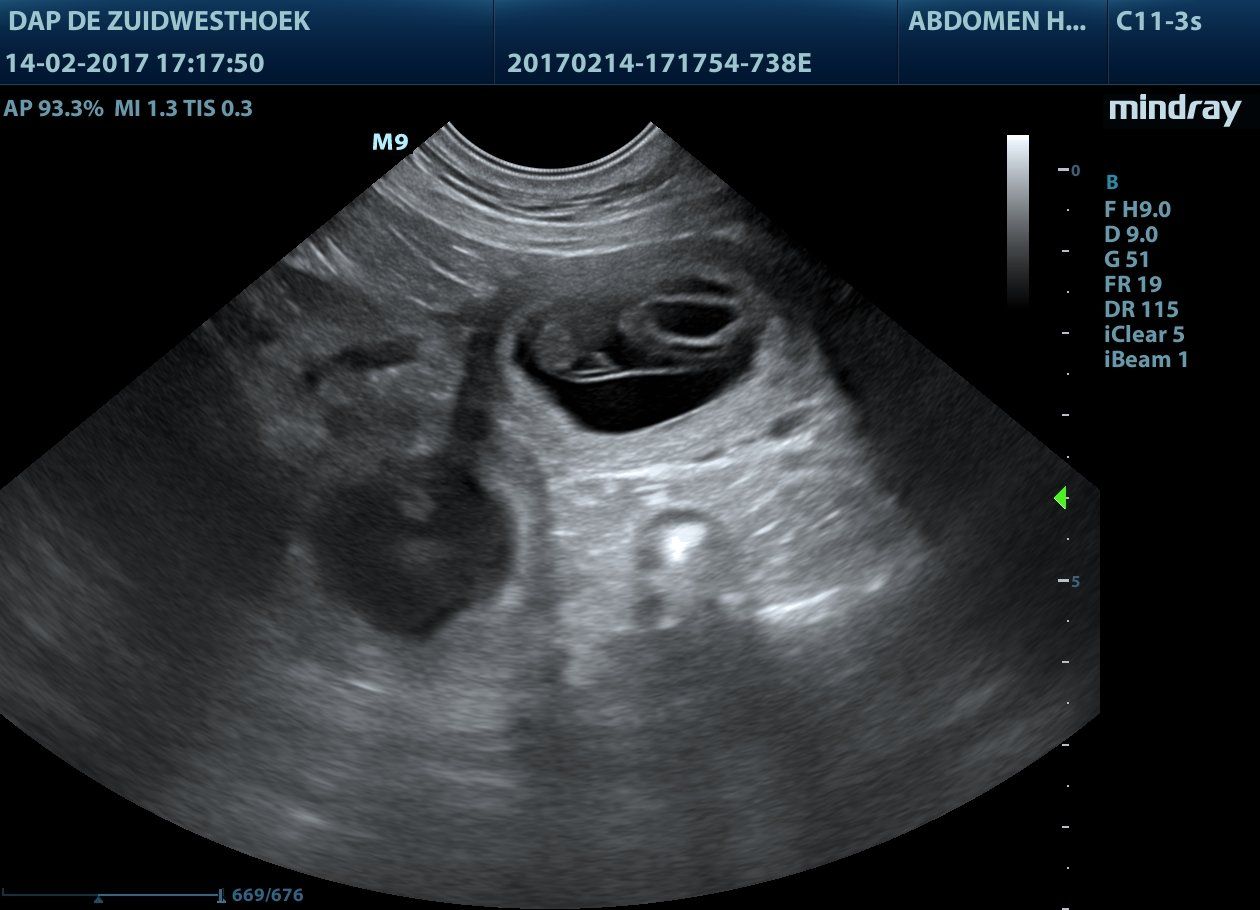 Echo van een drachtige hond