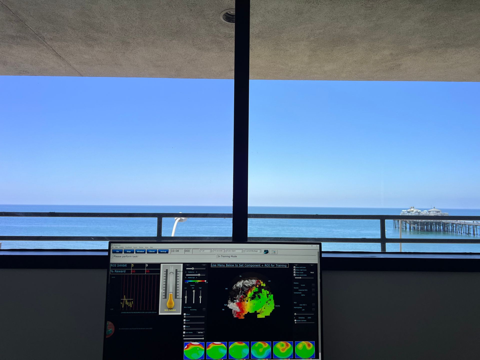 Edge Neurofitness - Neurofeedback