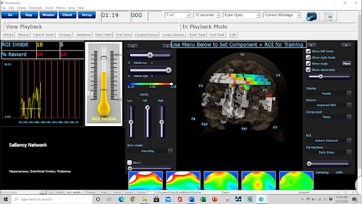 Neurofeedback