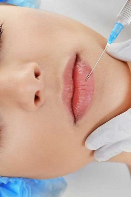 A woman is getting a botox injection in her lips.