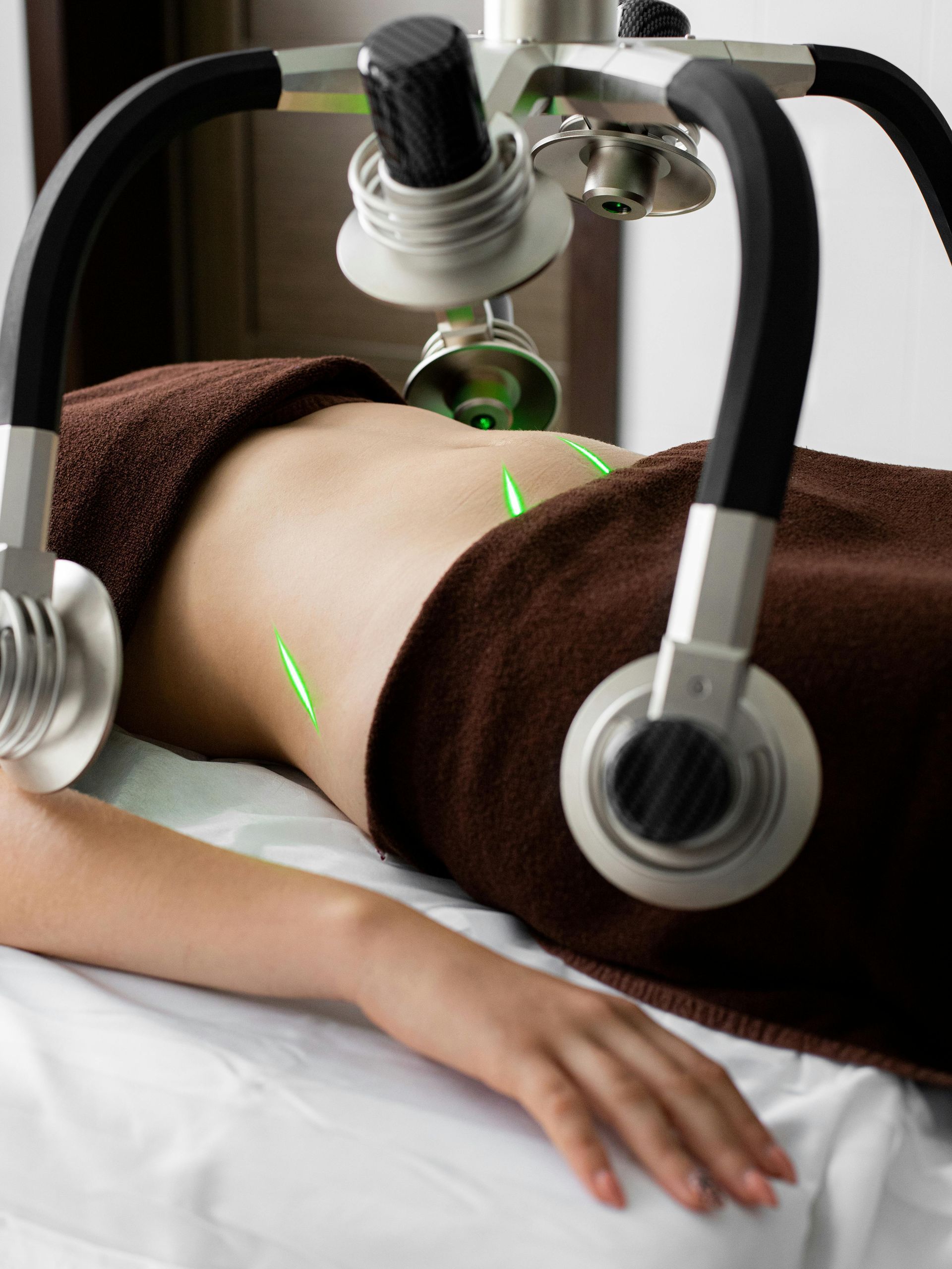 A woman is getting a laser treatment on her stomach