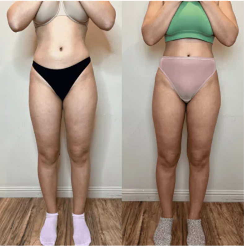 Two side-by-side photos. A person in underwear and a sports bra, legs slightly apart.