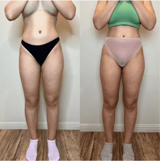 Two photos comparing a person's legs. Left: black underwear, pink socks. Right: pink underwear, gray socks.