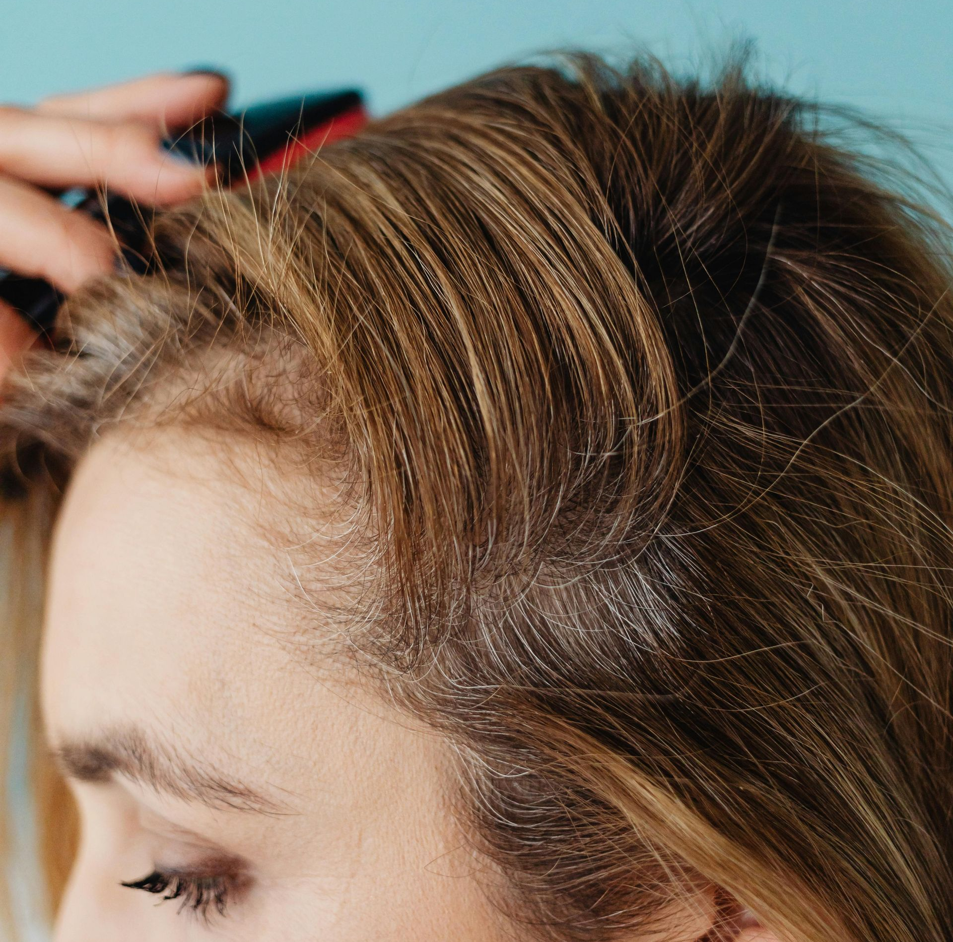 Sculptra Treatment at Kyle Farr Aesthetics