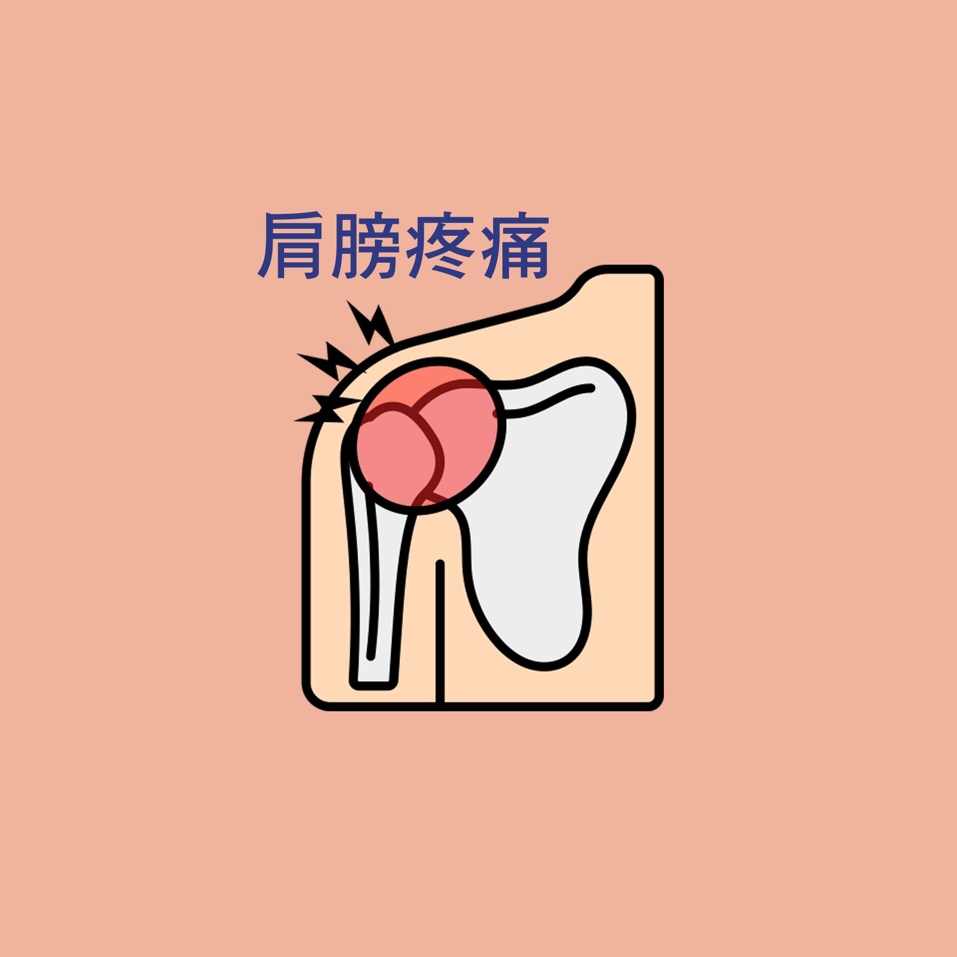 肩膀疼痛