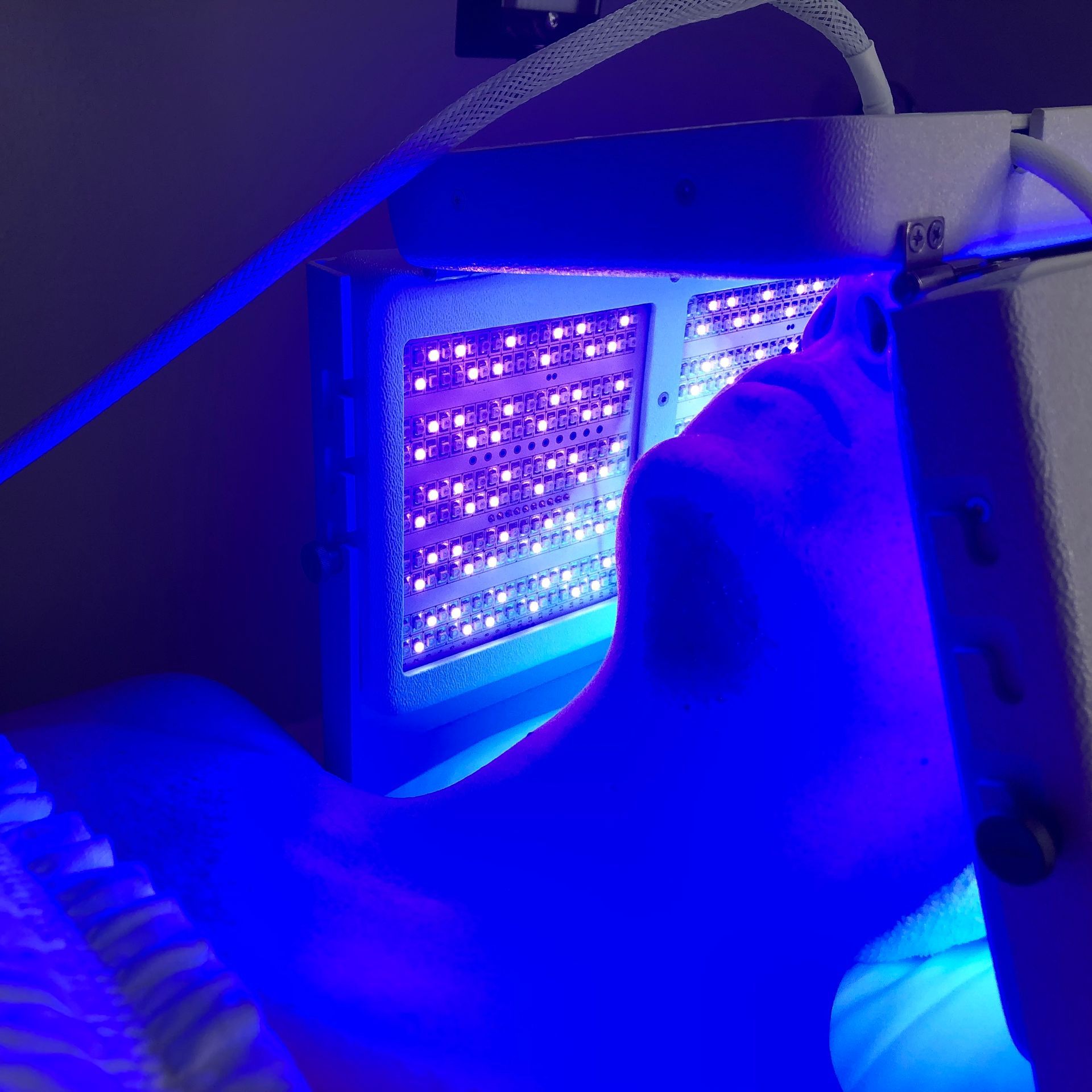 LED light therapy. Acne treatment