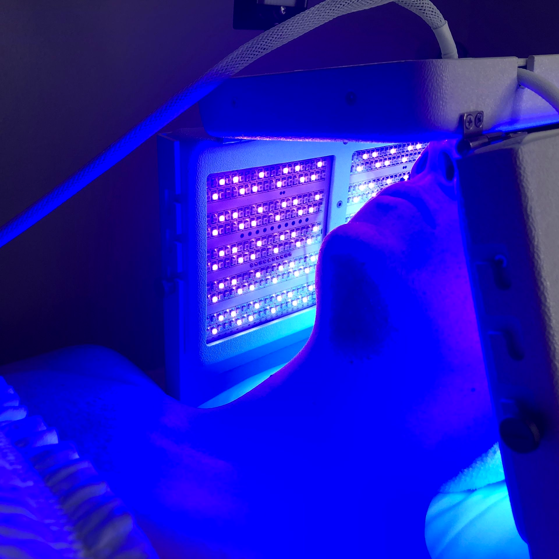 Blue LED therapy