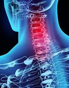 X-ray of human neck — Chiropractic Treatment in Phoenix, AZ