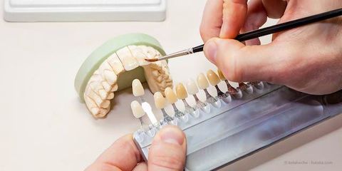 Zahnersatz aus dem praxiseigenen Dental-Labor