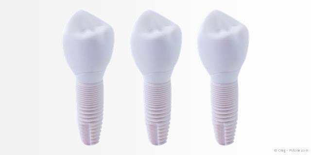 Keramik-Implantate: Besonders körperverträglich und ästhetisch Keramik-Implantate: Besonders körperverträglich und ästhetisch