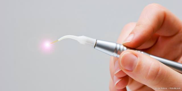 Dental-Laser für die blutungs- und schmerzarme Behandlung Dental-Laser für die blutungs- und schmerzarme Behandlung
