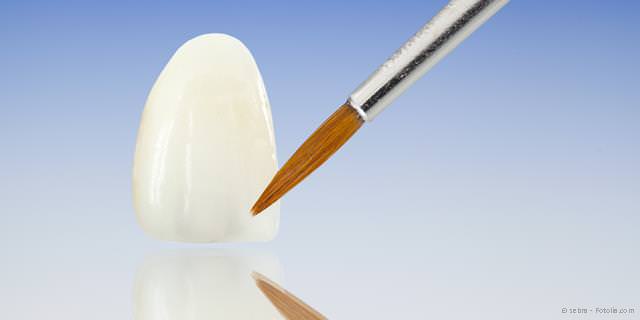 Individuelle Zahnersatzgestaltung im praxiseigenen Dentallabor Individuelle Zahnersatzgestaltung im praxiseigenen Dentallabor