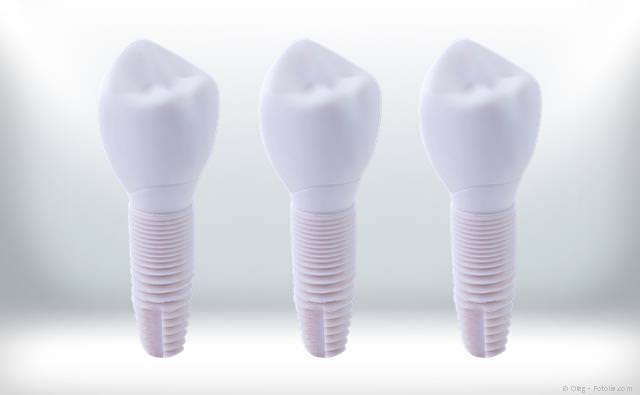Keramik-Implantate aus Zirkondioxid: Gut körperverträglich