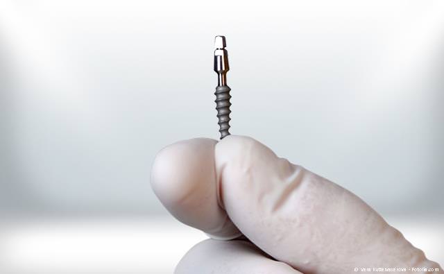 Implantation ohne Skalpell und Nadel: Schonender und schneller als herkömmliche Implantationsverfahren