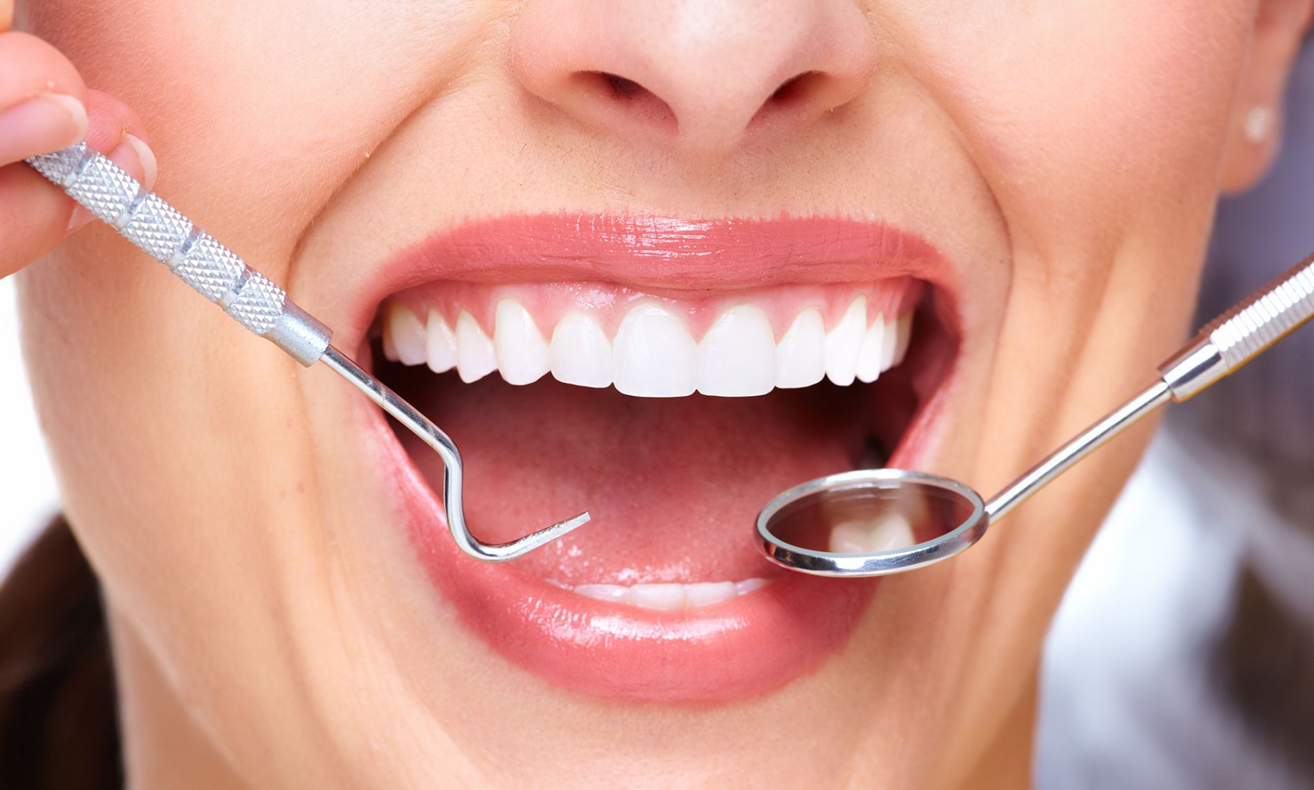 Sbiancamento professionale