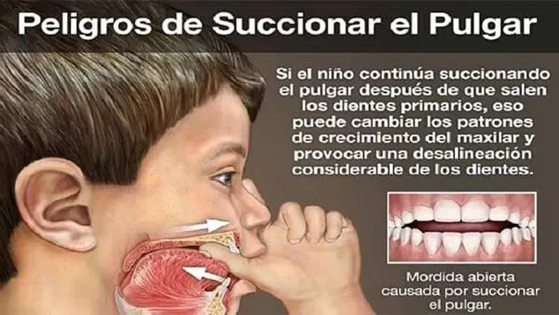 ODONTOPEDIATRA DRA JACQUELINE HUERTA VICARTTE
