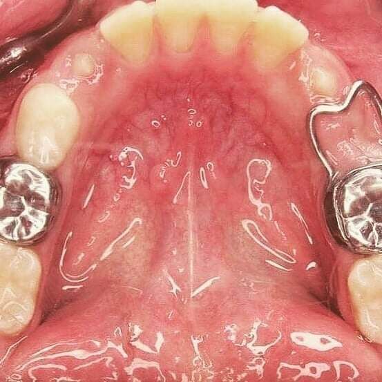 ODONTOPEDIATRA DRA JACQUELINE HUERTA VICARTTE