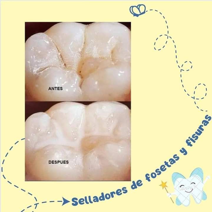 ODONTOPEDIATRA DRA JACQUELINE HUERTA VICARTTE