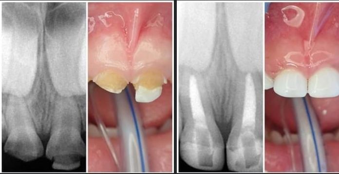 ODONTOPEDIATRA DRA JACQUELINE HUERTA VICARTTE
