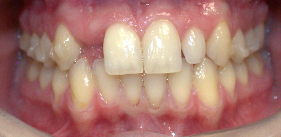 Ottawa Dental Care  -  Before and After