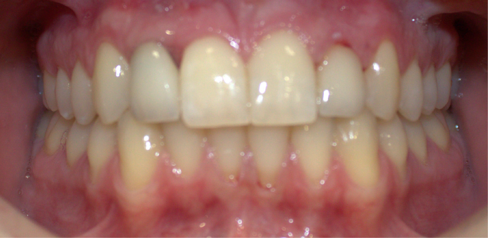 Ottawa Dental Care - Before and after